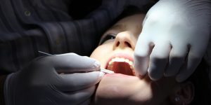 overcoming dentist fear
